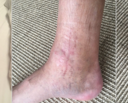 Adventures Of The Leg 2019 Edition!